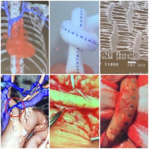 『栃木県腎不全透析看護勉強会』